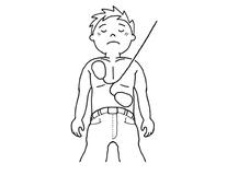 仰向けになった上半身裸になっている男性に左胸と右腹部にAEDの電極パットを張っているイラスト